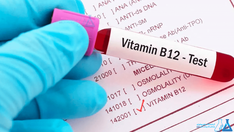 آزمایش Vitamin B12